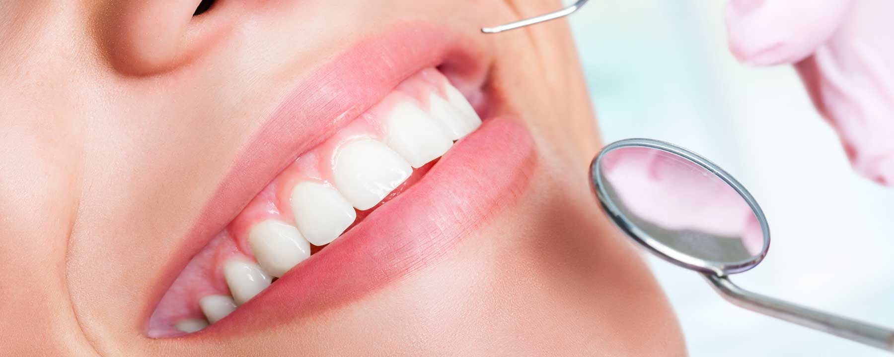 affordable straight teeth