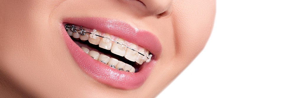 Orthodontics
