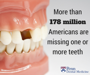 What Is A Prosthodontist Trailhead Dental